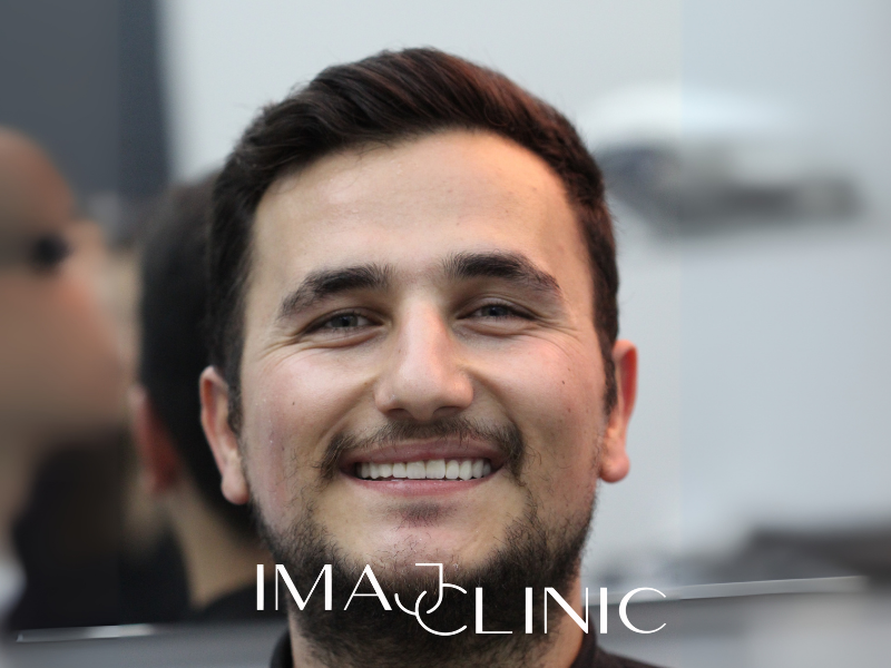 Tedavi Sonrası