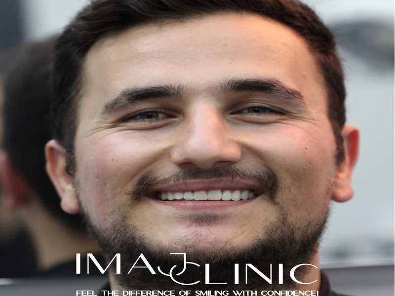 Tedavi Sonrası