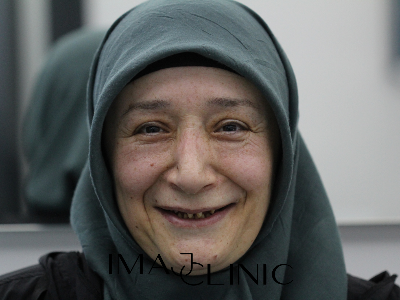 Tedavi Öncesi