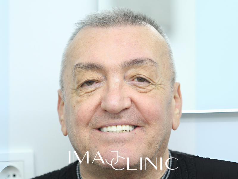 Tedavi Sonrası